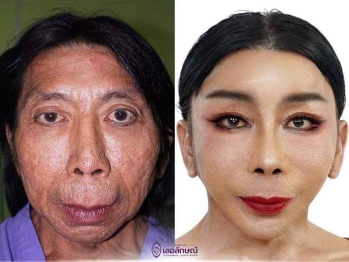 泰國「性感熟女網紅」整容後的近照曝光!她坦言想整成范冰冰!
