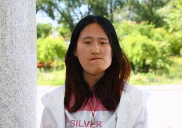 小時候因一場病 「漂亮臉蛋變歪了」整容後變女神級老師 拒絕「做網紅賺錢」