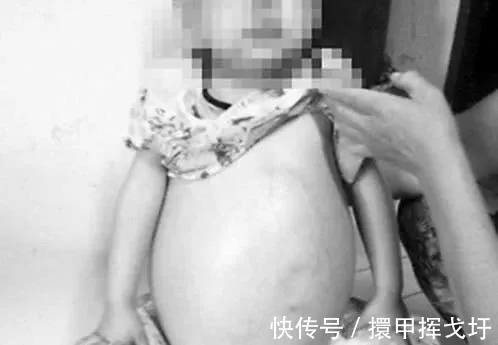 7歲小女孩「懷孕」,醫生取出「胎兒」後,父母懷疑自己的眼睛