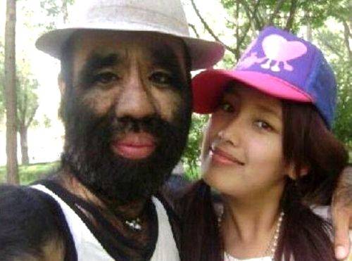 世界上「體毛最長」的人,毛髮覆蓋率96%,剪掉毛髮後,美得讓人羨慕!