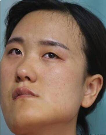 小時候因一場病 「漂亮臉蛋變歪了」整容後變女神級老師 拒絕「做網紅賺錢」