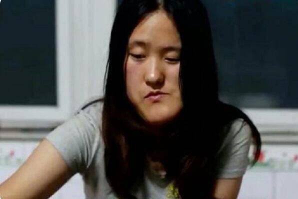 小時候因一場病 「漂亮臉蛋變歪了」整容後變女神級老師 拒絕「做網紅賺錢」