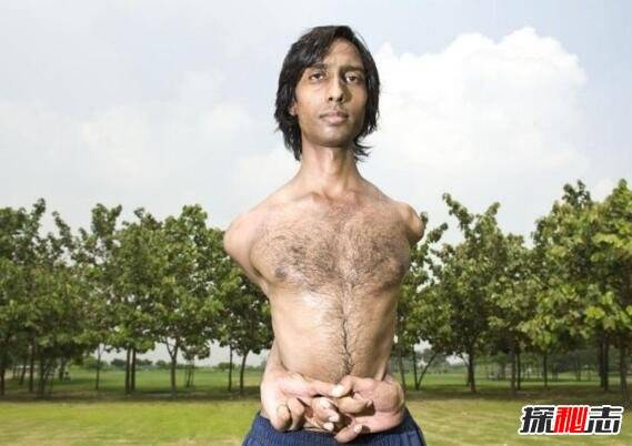 男子能隨意折疊扭曲自己身體 是現實中的橡膠人,超強柔韌性 能擠進很小空間:看成龍電影學的