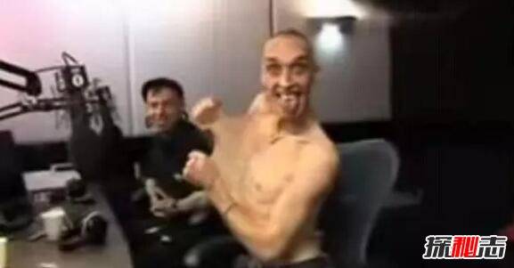 男子能隨意折疊扭曲自己身體 是現實中的橡膠人,超強柔韌性 能擠進很小空間:看成龍電影學的