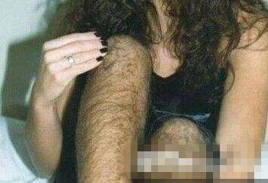 世界上「體毛最長」的人,毛髮覆蓋率96%,剪掉毛髮後,美得讓人羨慕!