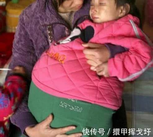7歲小女孩「懷孕」,醫生取出「胎兒」後,父母懷疑自己的眼睛