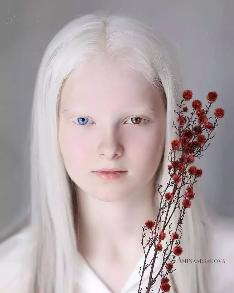 雪國來的精靈♥️白化女孩「絕美褐藍異色雙瞳」爆紅全網 睜開雙眼睛瞬間「宛如空靈天使下凡」太迷人