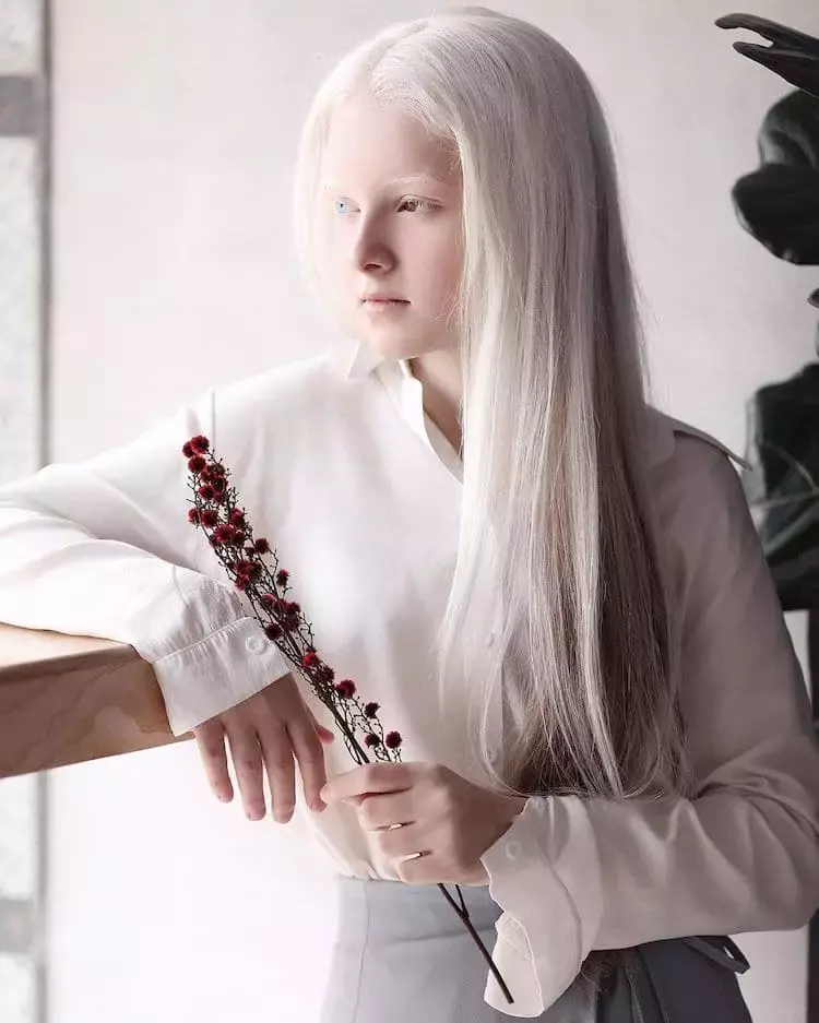 雪國來的精靈♥️白化女孩「絕美褐藍異色雙瞳」爆紅全網 睜開雙眼睛瞬間「宛如空靈天使下凡」太迷人