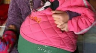7歲小女孩「懷孕」，醫生取出「胎兒」後，父母懷疑自己的眼睛