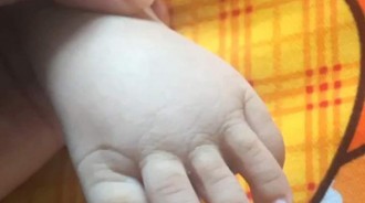 寶寶「腳趾」比手指還長？媽媽看了非常苦惱　網友紛紛擔憂：快去醫院 